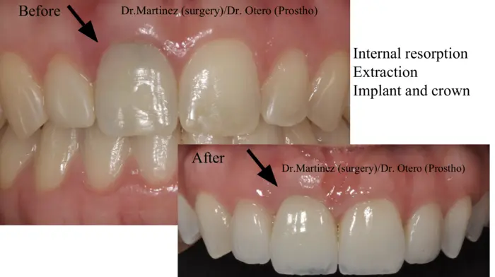 Clinical before-and-after case treated at the practice