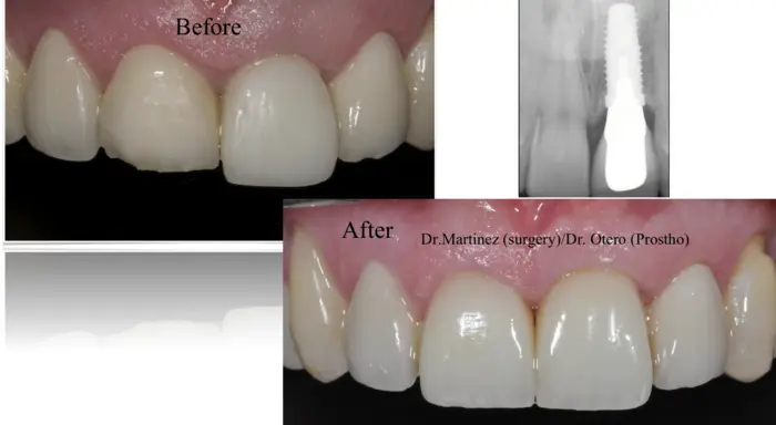 Clinical before-and-after case treated at the practice