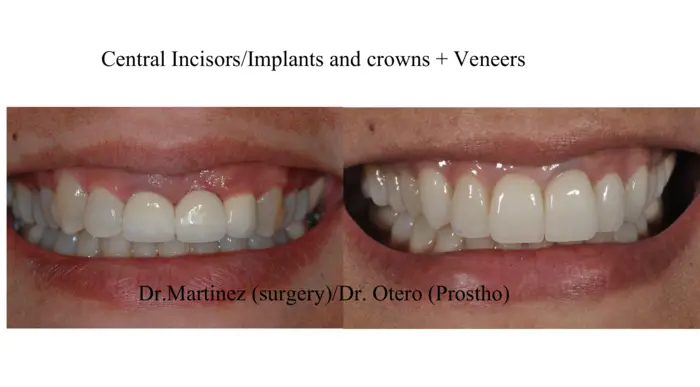 Clinical before-and-after case treated at the practice