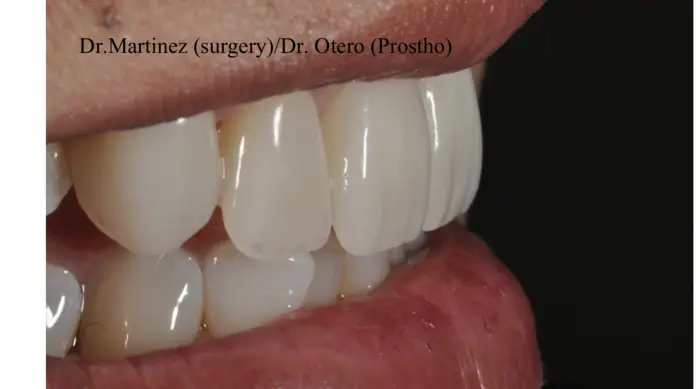 Clinical before-and-after case treated at the practice