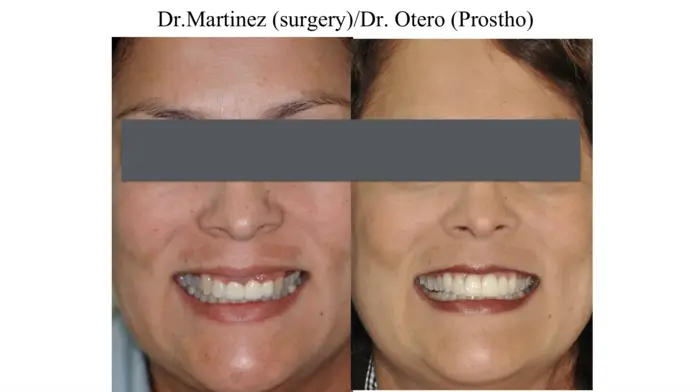 Clinical before-and-after case treated at the practice