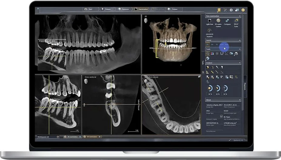 CBCT 3D Imaging